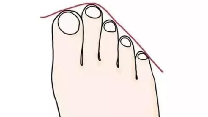 Tướng bàn chân có ngón thứ 2 dài nhất