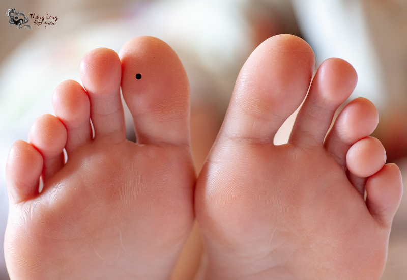 Nốt ruồi ở ngón chân thường mang ý nghĩa tốt cho người sở hữu nó