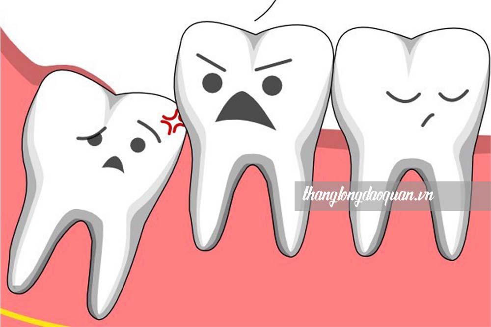 Tháng cô hồn có nên nhổ răng không?